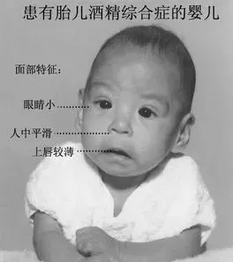 15120111246144.png